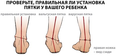установка